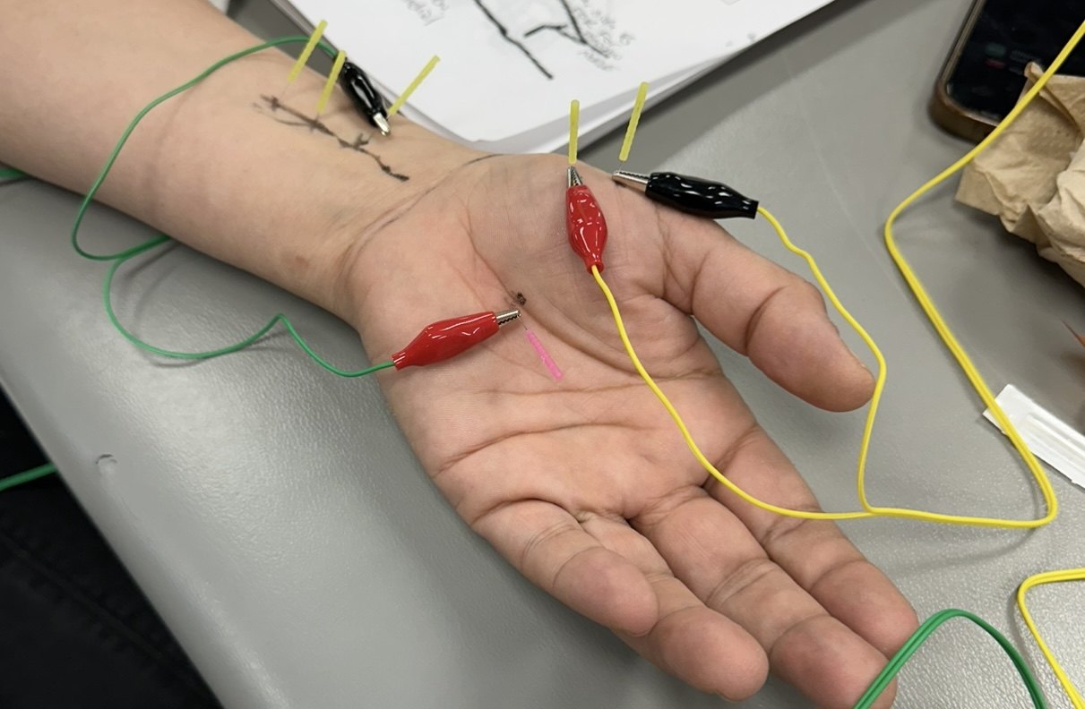 Dry Needling
